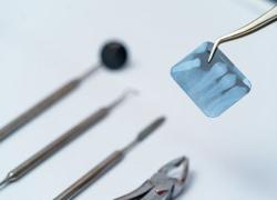 Безопасность рентгеновских снимков в стоматологии